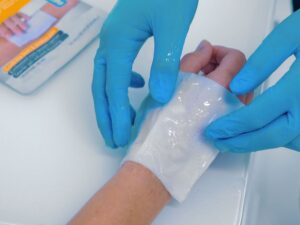 Burn Care